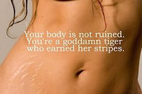 Momma Bees: POST BABY BODY :  wedding Stretchmarks