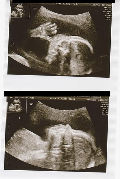 Ladies due in the Summer/Fall 2011 - Gender Updates and Baby/Bump Pictures!!! :  wedding babies second trimester gender bump pictures belly Twin 1 At 22 Weeks Plus One Day ED
