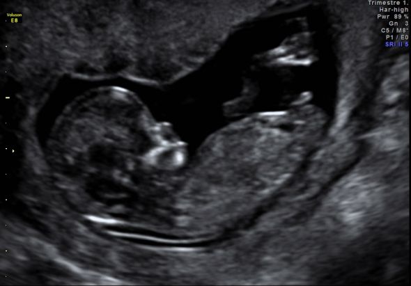 August 2012 Mamas Part III : wedding Baby T