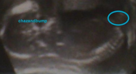 The nub theory - predicting gender early :  wedding Nup2