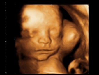May Babies Part 3 :  wedding BABY BOY LEE 0006