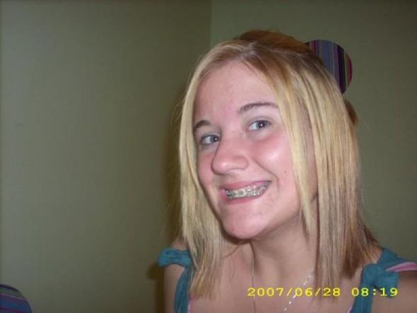 Before and After - Brides with Braces! :  wedding L B6e5fa8057470dceea2c3262a03dc653