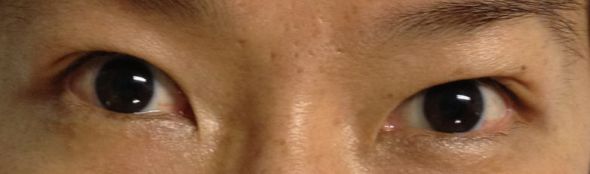 eyelash extension for asians : wedding eyelash extension asian Eye1 Before