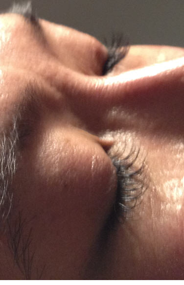 eyelash extension for asians :  wedding eyelash extension asian Eye2 After Different Visit