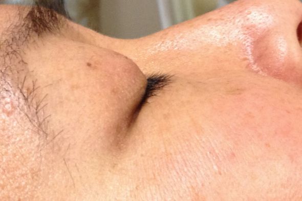 eyelash extension for asians : wedding eyelash extension asian Eye2 Before