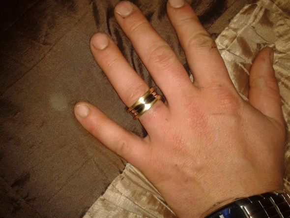 His ring!