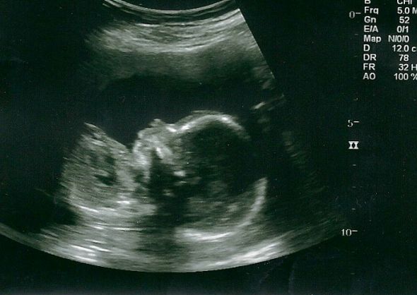 It's a girl!!!! : wedding Girl0001