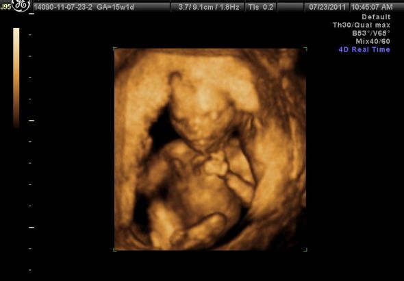 January 2012 Babies : wedding january babies 2012 1 Baby Hoff 15W Pic 1
