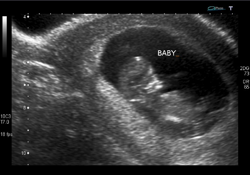 Spring 2012 Babies - Part 6 :  wedding Ziggy11wprofile