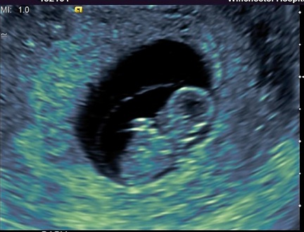 August 2012 Mamas Part II :  wedding Ultrasound2
