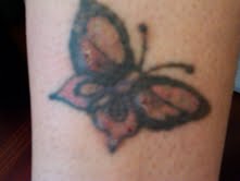 Tattoo Removal : wedding 2 Month Butterfly