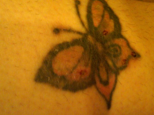 Tattoo Removal : wedding IMG00116 20110528 1943