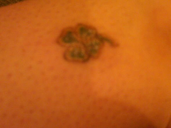 Tattoo Removal :  wedding IMG00118 20110528 1943