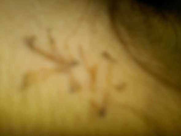 Tattoo Removal : wedding IMG00121 20110528 2029