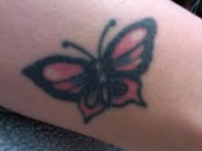 Tattoo Removal : wedding Butterfly