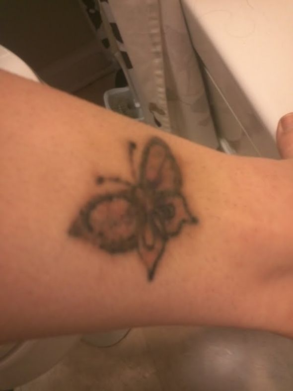 Tattoo Removal :  wedding Butterfly123