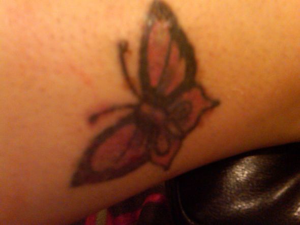 Tattoo Removal : wedding Butterfly14