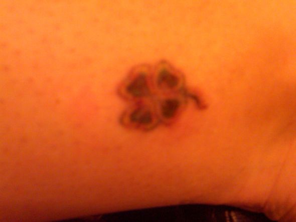 Tattoo Removal : wedding Clover14