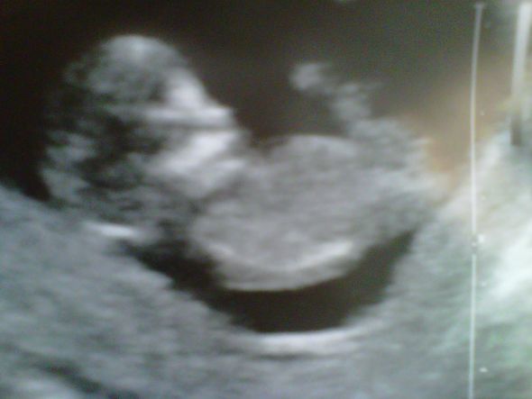 Ladies due in the Summer/Fall 2011 - Gender Updates and Baby/Bump Pictures!!! :  wedding babies second trimester gender bump pictures belly IMG00236 20110107 1001