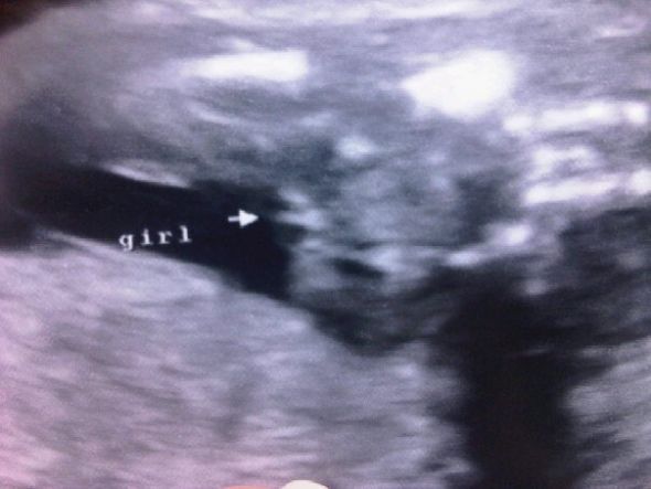 January 2012 Babies : wedding january babies 2012 1 294012 200240936702179 100001488213421 547861 2876426 N