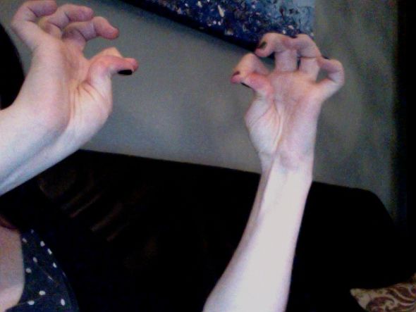 Anybody else have any weird body parts? I have elf ears! :p :  wedding Photo On 2010 10 30 At 20.57