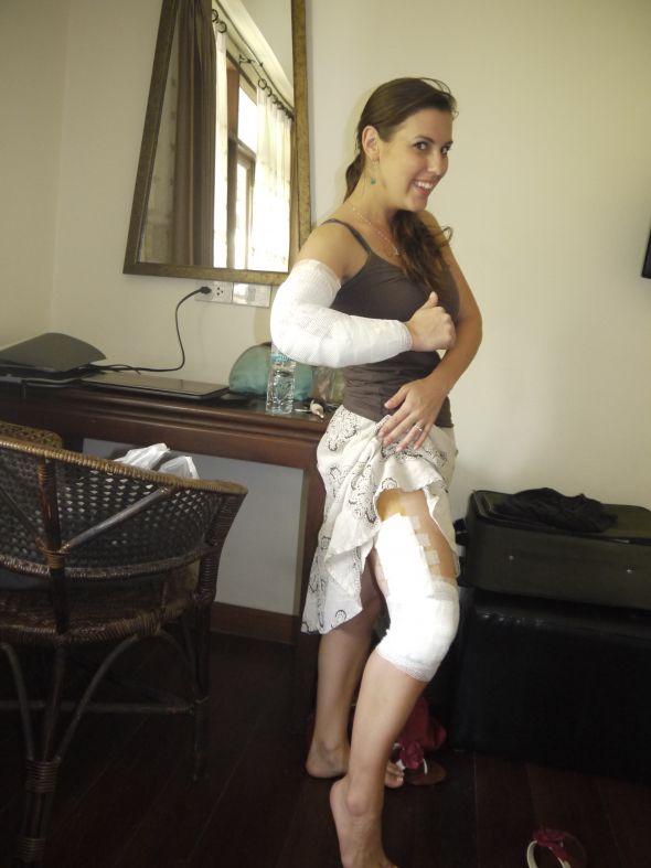 Horrible (amazing) honeymoon :  wedding honeymoon thailand accident P1010430