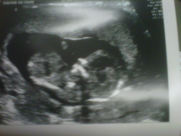 The nub theory - predicting gender early :  wedding IMG00520 20120206 1135