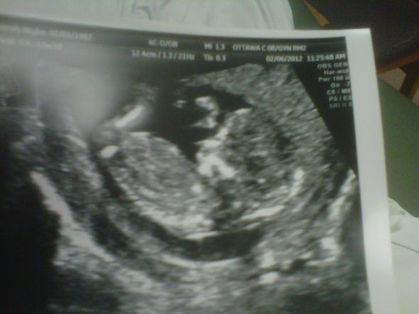 The nub theory - predicting gender early :  wedding IMG00521 20120206 1135